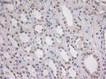 Notch1 Antibody in Immunohistochemistry (Paraffin) (IHC (P))