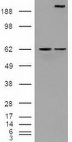 Notch1 Antibody in Western Blot (WB)