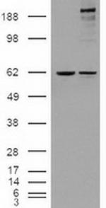 Notch1 Antibody in Western Blot (WB)