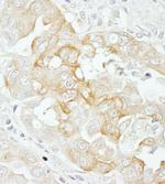 Notch2 Antibody in Immunohistochemistry (IHC)