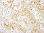 Notch2 Antibody in Immunohistochemistry (IHC)