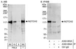 Notch2 Antibody in Western Blot (WB)