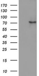 OAS2 Antibody in Western Blot (WB)