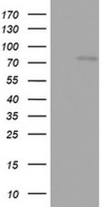 OAS2 Antibody in Western Blot (WB)