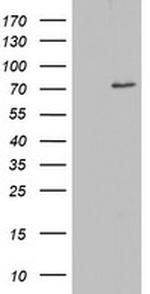 OAS2 Antibody in Western Blot (WB)