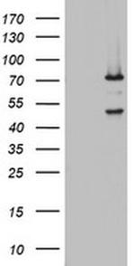 OAS2 Antibody in Western Blot (WB)