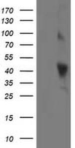 OBFC1 Antibody in Western Blot (WB)