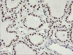 OBFC2B Antibody in Immunohistochemistry (Paraffin) (IHC (P))