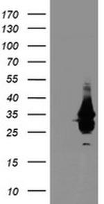 OBFC2B Antibody in Western Blot (WB)