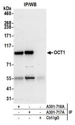 OCT1 Antibody in Western Blot (WB)