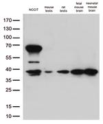 OCT4 Antibody in Western Blot (WB)