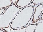 OGFOD1 Antibody in Immunohistochemistry (Paraffin) (IHC (P))