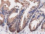 OGFOD1 Antibody in Immunohistochemistry (Paraffin) (IHC (P))