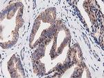 OGFOD1 Antibody in Immunohistochemistry (Paraffin) (IHC (P))