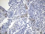 OIP5 Antibody in Immunohistochemistry (Paraffin) (IHC (P))