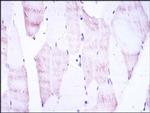 OLIG2 Antibody in Immunohistochemistry (Paraffin) (IHC (P))