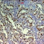 BrdU Antibody in Immunohistochemistry (Paraffin) (IHC (P))