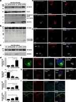 Amyloid Precursor Protein Antibody in Immunocytochemistry (ICC/IF)