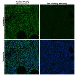 Vimentin Antibody in Immunohistochemistry (Paraffin) (IHC (P))