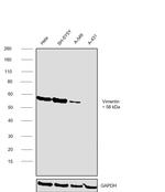 Vimentin Antibody