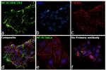 NEFM Antibody