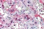 AVPR1B Antibody in Immunohistochemistry (Paraffin) (IHC (P))