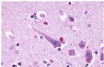 Prokineticin Receptor 2 Antibody in Immunohistochemistry (Paraffin) (IHC (P))