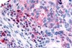 HRH4 Antibody in Immunohistochemistry (Paraffin) (IHC (P))