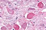 GALR2 Antibody in Immunohistochemistry (Paraffin) (IHC (P))