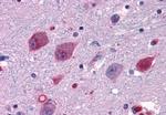 P2Y14 Antibody in Immunohistochemistry (Paraffin) (IHC (P))