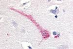 RON Antibody in Immunohistochemistry (Paraffin) (IHC (P))