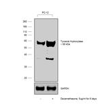 Tyrosine Hydroxylase Antibody