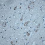 ATG16L1 Antibody in Immunohistochemistry (Paraffin) (IHC (P))