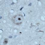 ATG16L1 Antibody in Immunohistochemistry (Paraffin) (IHC (P))