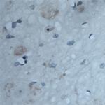 ATG16L1 Antibody in Immunohistochemistry (Paraffin) (IHC (P))