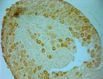 AKT Antibody in Immunohistochemistry (Paraffin) (IHC (P))