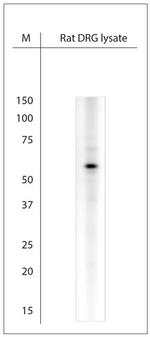 extracellular ASIC1 Antibody in Western Blot (WB)