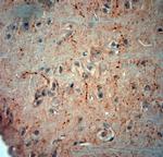 extracellular ASIC3 Antibody in Immunohistochemistry (Paraffin) (IHC (P))