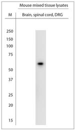 ATP5A1 Antibody in Western Blot (WB)