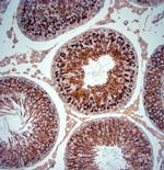 Artemin Antibody in Immunohistochemistry (Paraffin) (IHC (P))