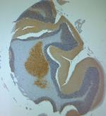 Aggrecan Antibody in Immunohistochemistry (Paraffin) (IHC (P))