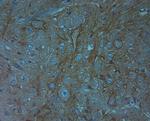 Aggrecan Antibody in Immunohistochemistry (Paraffin) (IHC (P))