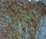 Aggrecan Antibody in Immunohistochemistry (Paraffin) (IHC (P))