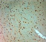 ARX Antibody in Immunohistochemistry (Paraffin) (IHC (P))