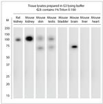 ACE2 Antibody in Western Blot (WB)