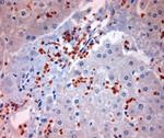 BBS2 Antibody in Immunohistochemistry (Paraffin) (IHC (P))