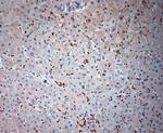 BBS2 Antibody in Immunohistochemistry (Paraffin) (IHC (P))