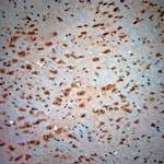 BDKRB2 Antibody in Immunohistochemistry (Paraffin) (IHC (P))