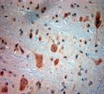 BDKRB2 Antibody in Immunohistochemistry (Paraffin) (IHC (P))