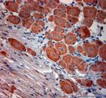 BDKRB2 Antibody in Immunohistochemistry (Paraffin) (IHC (P))